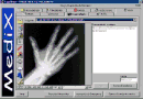 Medix v1.2
